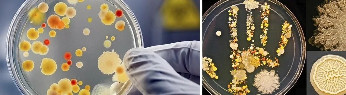 Бактерии в слюне. Микроорганизмы в слюне человека. Слюна в чашке Петри. Круглые бактерии в слюне.