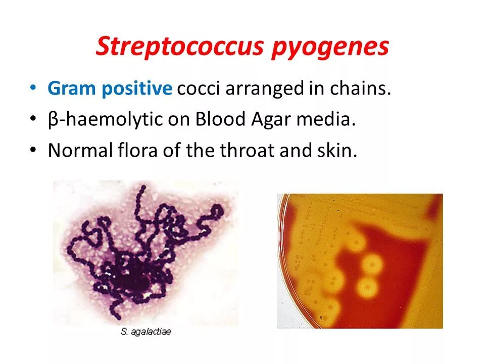 Streptococcus pyogenes. Стрептококк пиогенес (streptococcus pyogenes. стрептококк пиогенес микробиология морфология. streptococcus pyogenes 10 6 коемл. для белка м streptococcus pyogenes характерно:.