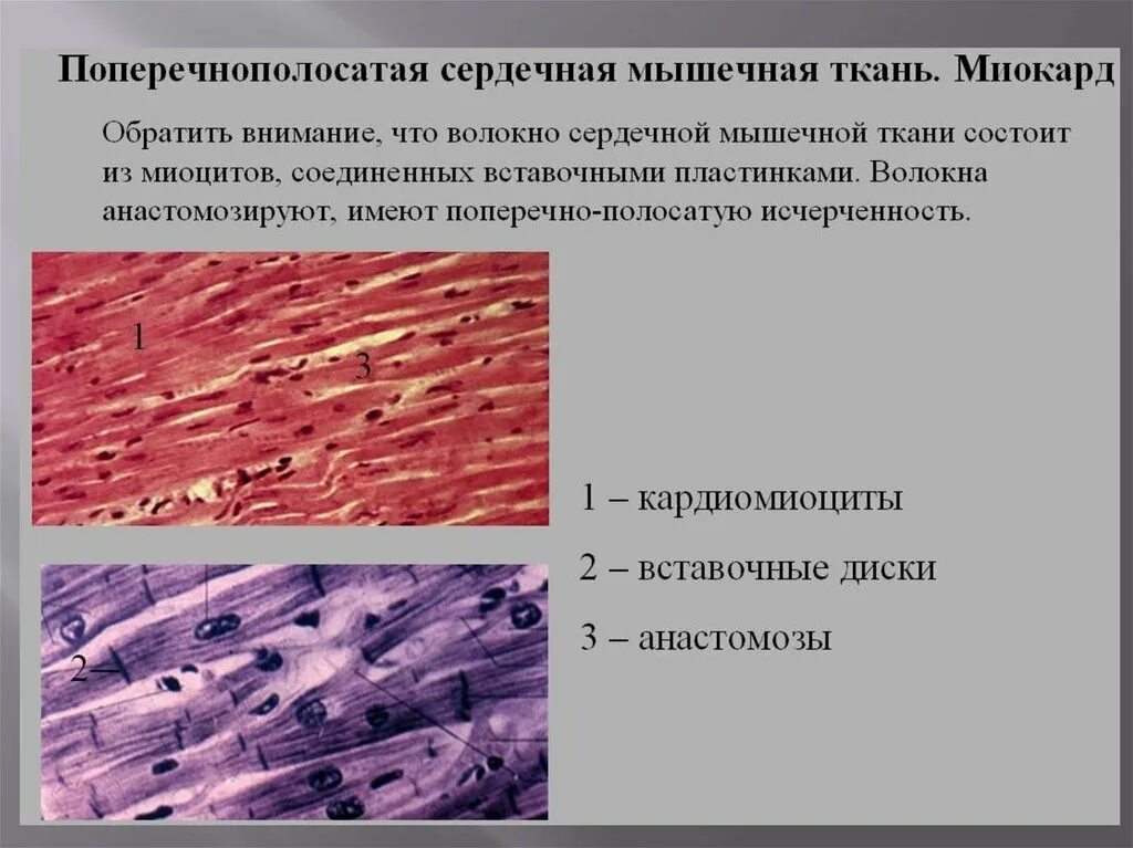 Клетка сердечной поперечно полосатой мышечной ткани. Поперечнополосатая сердечная мышечная ткань препарат. Сердечная мышечная ткань гистология препарат. Поперечнополосатая Скелетная мышечная ткань препарат. Поперечнополосатая сердечная мышечная ткань миокард.