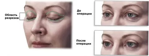 Продукция веко