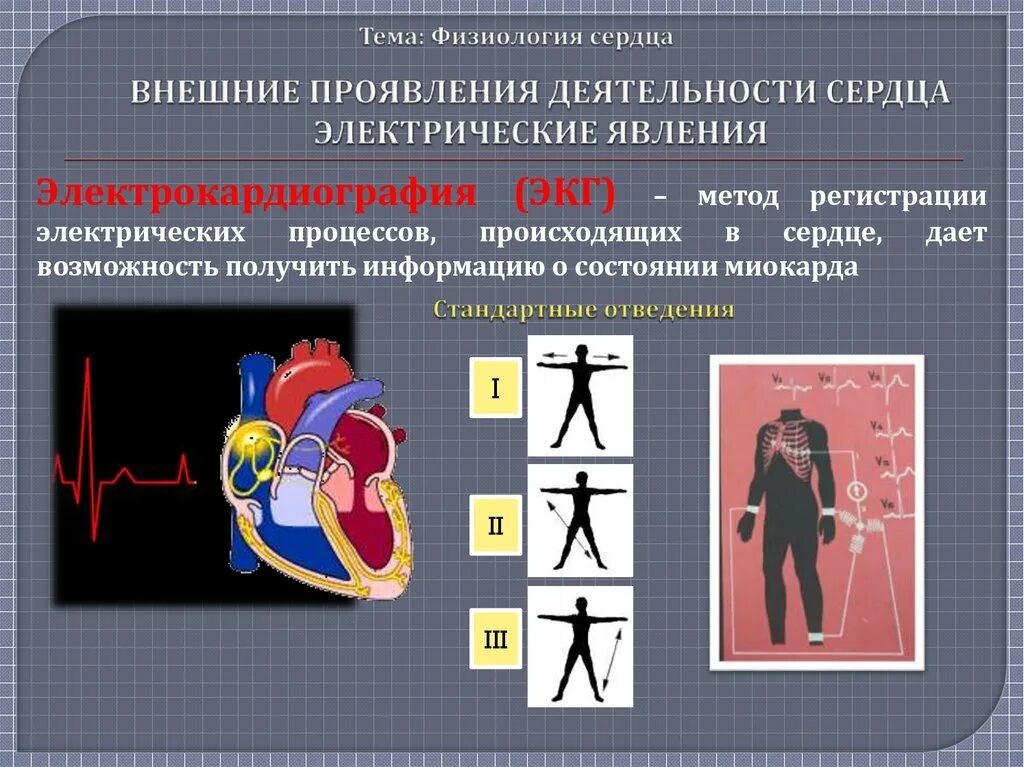 Экг и электрические явления в сердце. Электрические явления в сердце экг. Электрические явления в сердце. Экг и электрические явления в сердце. Экг и электрические явления в сердце.