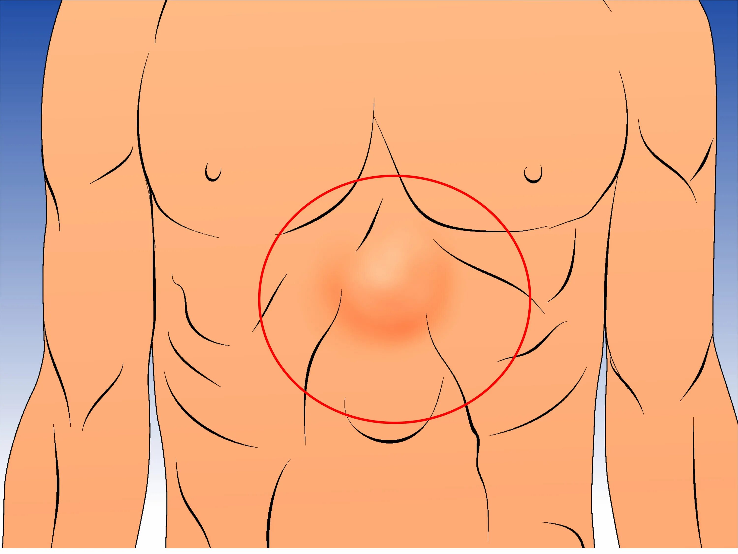 Пульсирующий живот у мужчин. Солнечное сплетение мечевидный отросток. Грыжf мечевидного отростка.