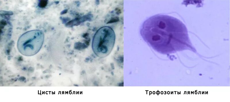 Lamblia intestinalis циста. Лямблии трофозоиты. Лямблия интестиналис циста. Лямблии вегетативная форма и цисты. Простейшие в кале лечение