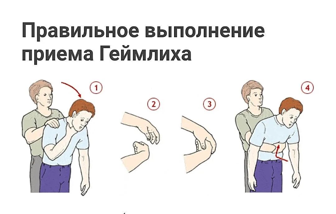Первая помощь задыхающемуся. Первая помощь если человек подавился и задыхается. что делать если человек подавился первая помощь. оказание помощи если человек подавился. если человек подавился, то что делать.