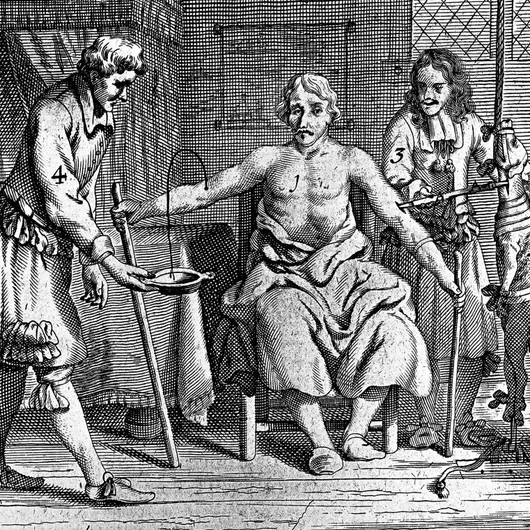 переливание крови в древности. екатерина медичи варфоломеевская варфоломеевская ночь. кровопускание в древности. екатерина медичи варфоломеевская ночь. варфоломеевская ночь во франции 24 августа 1572 г.