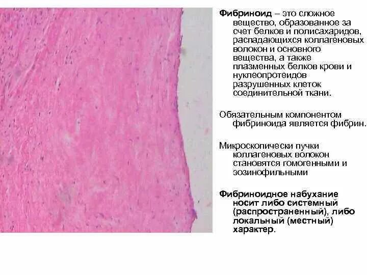 Мезенхимальные белковые. Мезенхимальные белковые дистрофии фибриноид. Фибриноид Лангханса Рора Нитабуха.