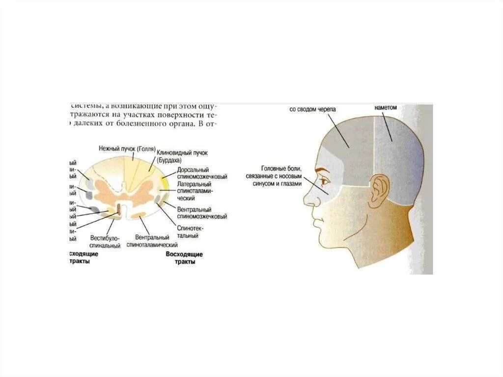 Боль в области лба причины. Схема локализации головной боли. Классификация головной боли по локализации. Зоны головы локализация боли. Болит голова в лобной части.