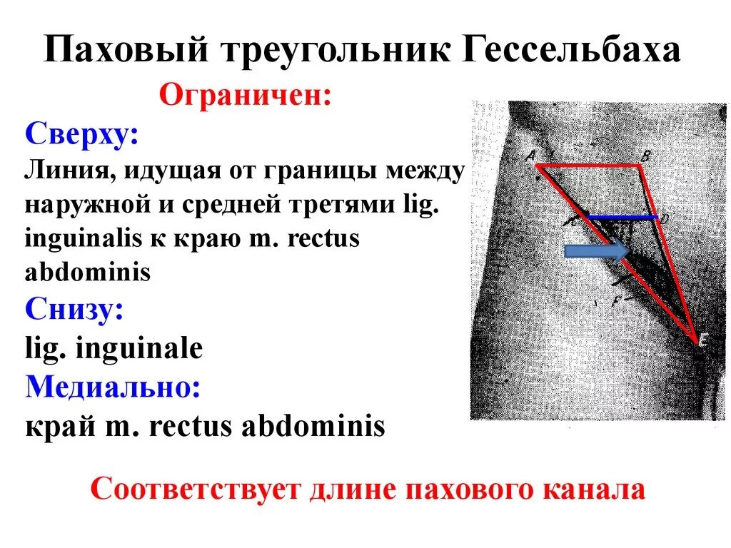 Болит паховая область у мужчин. Паховый канал топографическая анатомия треугольников. Топографическая анатомия пахового промежутка. Топография пахового канала паховый промежуток паховый треугольник. Треугольник Гессельбаха паховая.