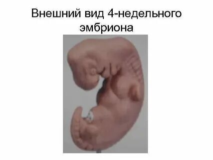 Эмбрион 11 мм