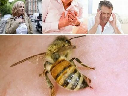 Что будет если оса укусит в