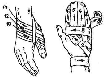 Техника наложения варежки