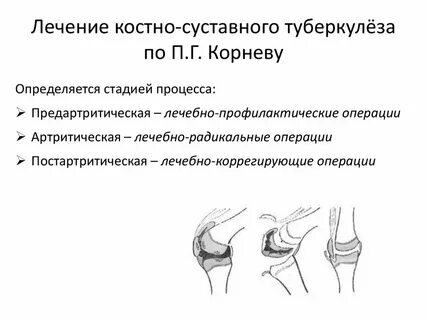 Фазы костно суставного туберкулеза