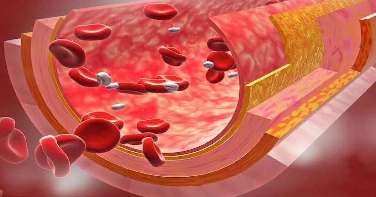 Эндотелий кровеносных сосудов. Что повреждает эндотелий сосудов. Стенка капилляра эндотелий. Эндотелиальные клетки сосудов.
