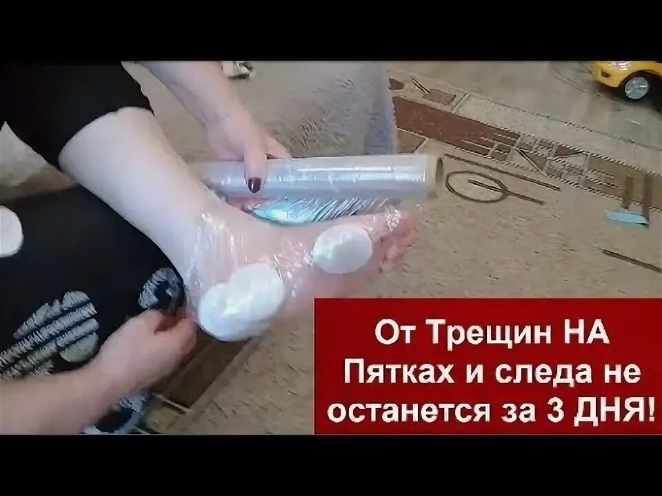 Обработка трещин на пятках. Зубная паста от трещин на пятках. Лайфхаки от трещин на пятках. Как убрать трещины на пятке.