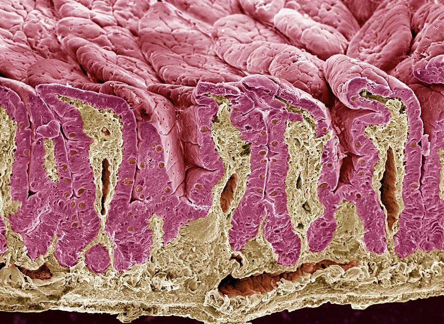 Ворсинки тонкого кишечника микрофотография. Внутренняя ткань кишечника. Микробиом кишечника человека. Ворсинки тонкого кишечника. Внутренняя ткань кишечника.