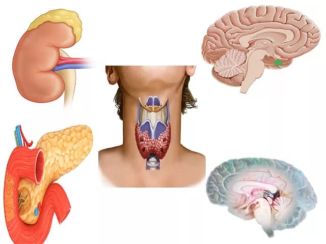 Эндокринные нарушения организма. Заболевания эндокринной системы. Эндокринная система забол. Эндокринные железы заболевания. Заболевания эндокринологической системы.