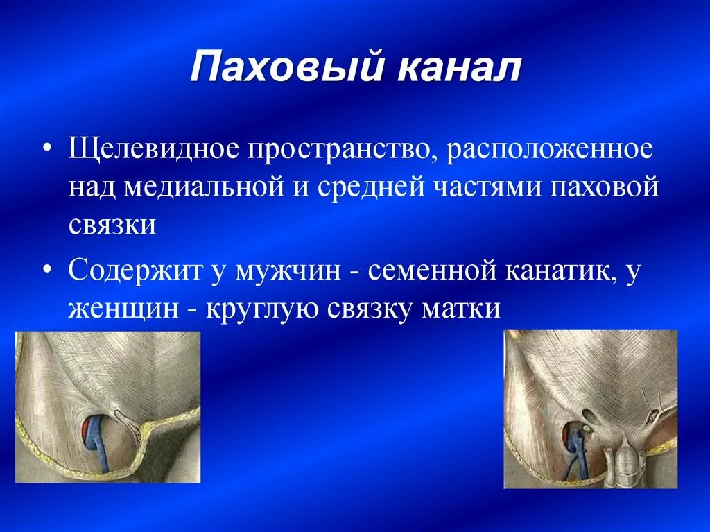 Паховый канал латынь. Анатомия пахового канала у женщин. Паховый канал и семенной канатик. Паховый канал наружное отверстие. Паховый канал строение колец.