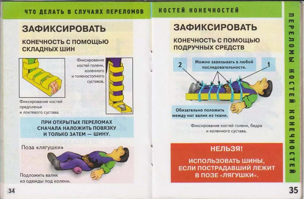 Причины переломов костей конечностей. Что необходимо выполнить в случае перелома конечностей?. оказание первой помощи. оказание первой помощи пострадавшим при переломах конечностей. что делать вслуче перелома.