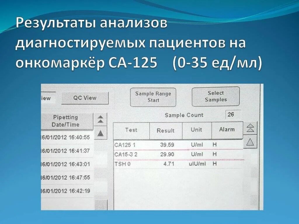 Результат крови са