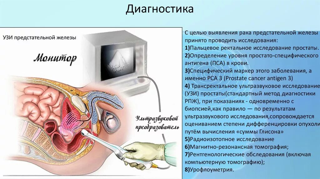 Простаты через прямую кишку. Методы исследования простаты. исследование предстательной железы. алгоритм обследования предстательной железы.