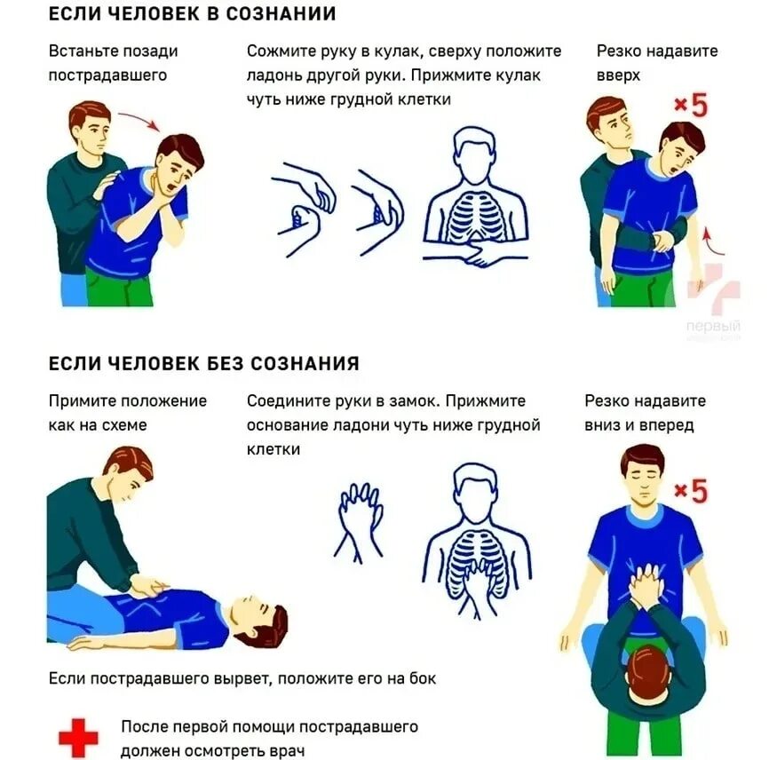 Методике приема Геймлиха. Приём Хаймлиха Геймлиха. Если человек подавился прием Геймлиха.