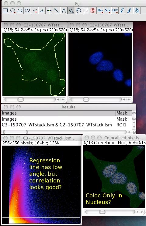 Программа imagej. Imagej программа. imagej морфология. imagej площадь по пикселям. fiji imagej.