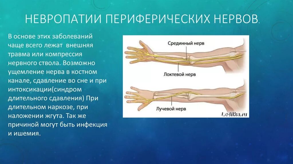 Неврит периферических нервов конечностей. Невропатия срединного периферического нерва. Невропатия локтевого и лучевого нерва. Периферические нервные стволы. Травма периферической нервной системы