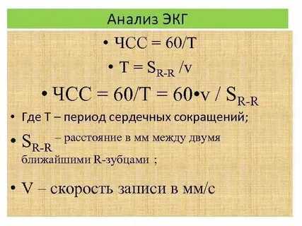Анализ экг