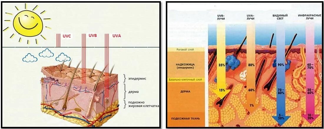 Воздействие УФ лучей на кожу. Ультрафиолетовое излучение воздействие на кожу. Воздействие УФ излучения на кожу. Воздействие ультрафиолетовых лучей на кожу. Кожа защищает организм от ультрафиолетовых лучей