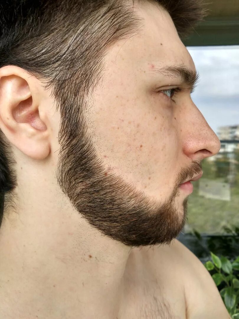 Рост волос на лице у мужчин. Отрастить бороду. Отращивание бороды. Густая борода. Щетина на лице.