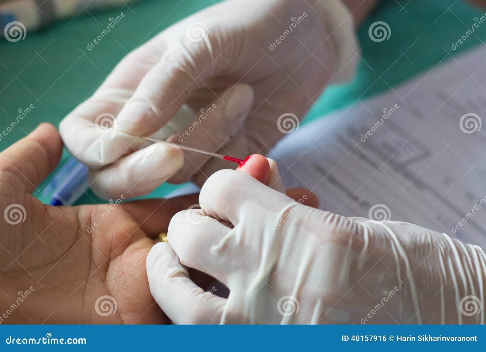 Стекло для взятия крови из пальца. Анализ крови из пальца можно ли есть