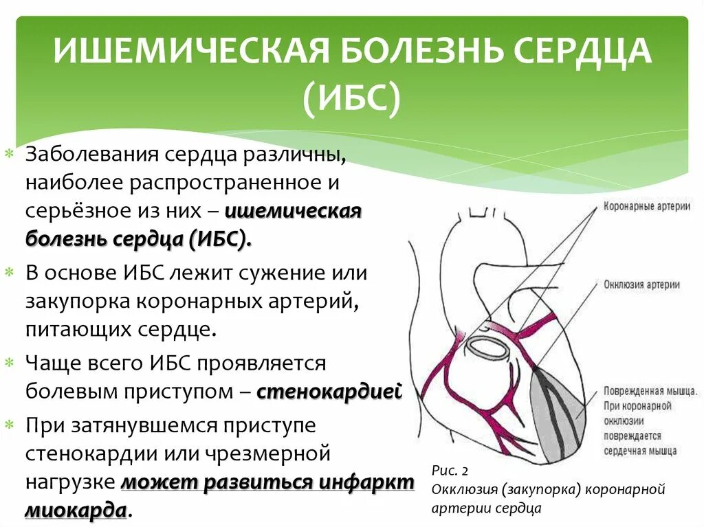 Ишемическая болезнь сердца (ибс). Профилактика ибс. Ишемическая болезнь сердца кардиологи. Ишемическая болезнь сердца симптомы. Ишемическая болезнь сердца кардиологи.