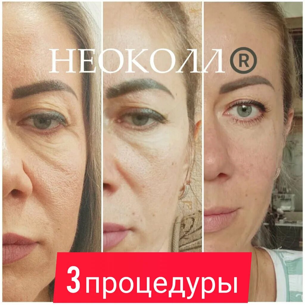 Веки хс. Веки хс