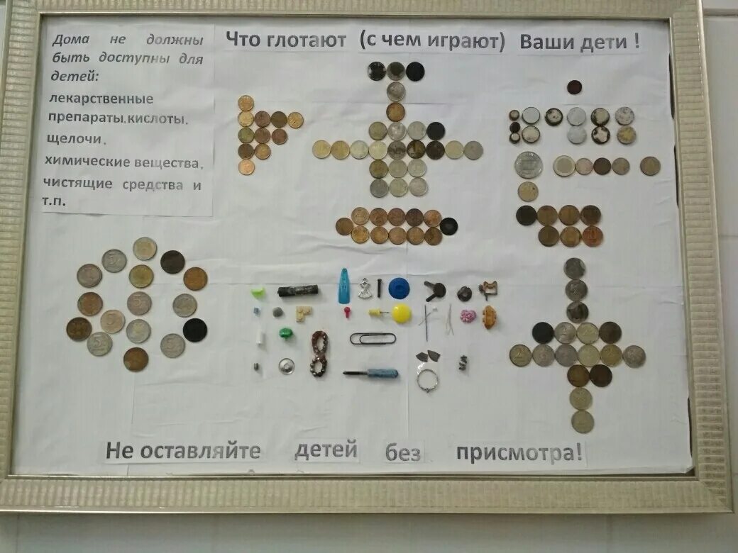 Проглотил через сколько выйдет. Что делать если ребёнок проглотил монетку. Что делать если ребенок проглотил монету. Что делать если ребенок проглотил монету 10 рублей. Что делать если ребенок проглотил рубль.