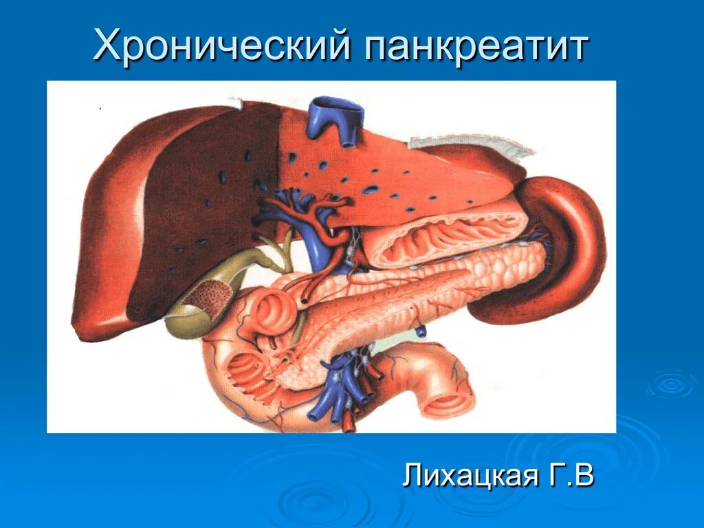 Хронический паренхиматозный панкреатит. Хронический панкреатит картинки. Хронический холецистит поджелудочной железы