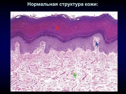 Дерма сосочковый слой сетчатый слой