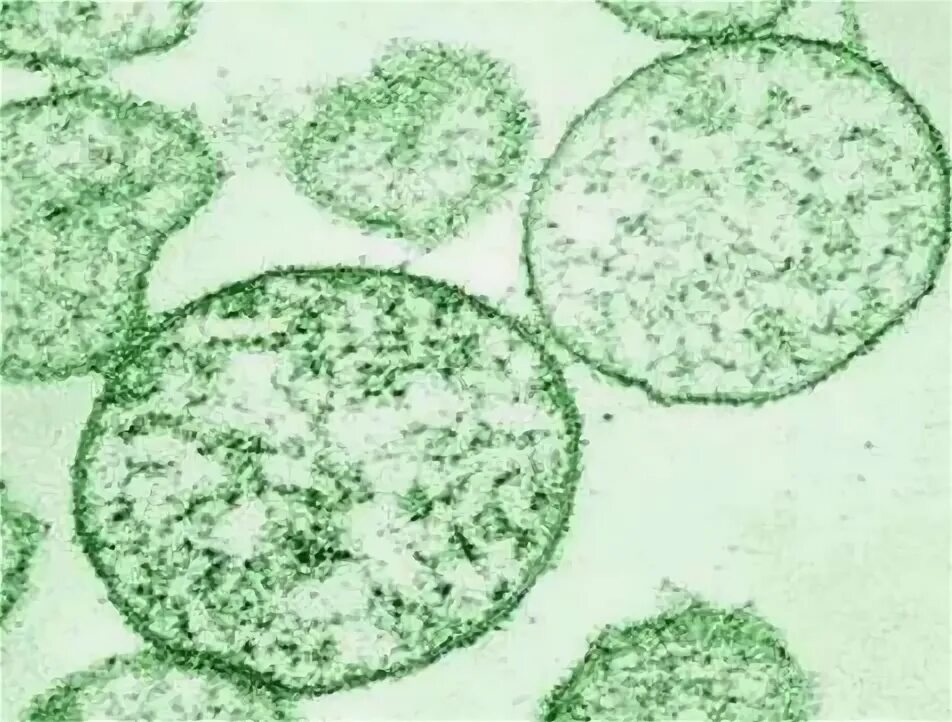 Микроорганизмы женских половых органов. Уреаплазмоз под микроскопом. Ureaplasma urealyticum иллюстрация.