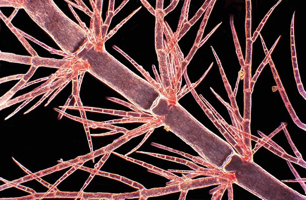 Красные водоросли клетки. Фукус микрофотография. Микрофотография красной водоросли. Микроскопические красные водоросли. Красные водоросли под микроскопом.