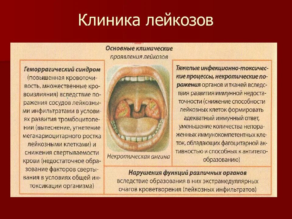 Острый лейкоз проявление. Симптоми острая лейкоза. Острый лейкоз клиника крови. Первые признаки крови у детей