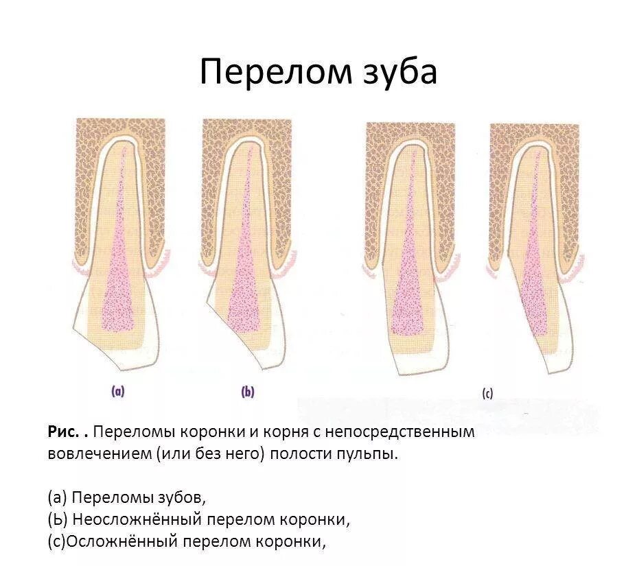 Удаление части корня