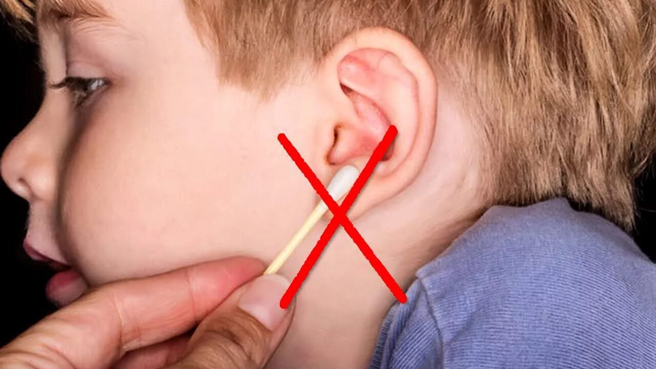 Сотрясение уха. Серная пробка в ухе у ребенка.