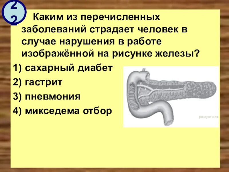 На рисунке изображен человек страдающий заболеванием. В случае нарушения железы какое заболевание. На рисунке изображён человек страдающий заболеванием. На рисункеизобрадён человек страдающий заболеванием. Из какого.