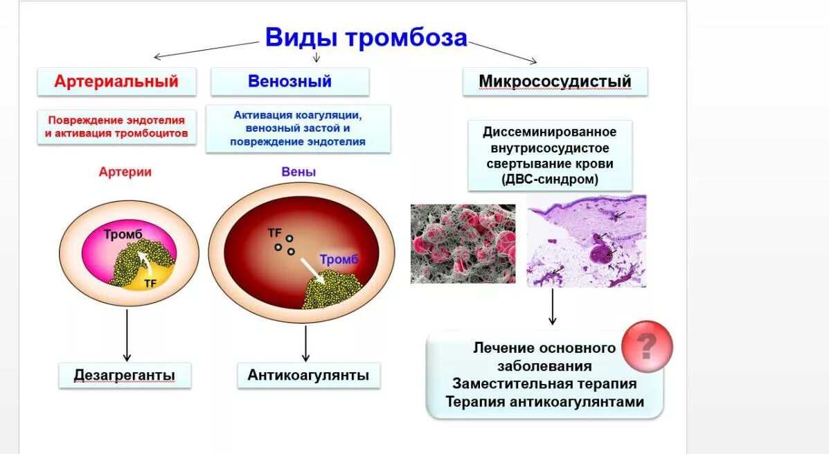 Факторы образования тромба