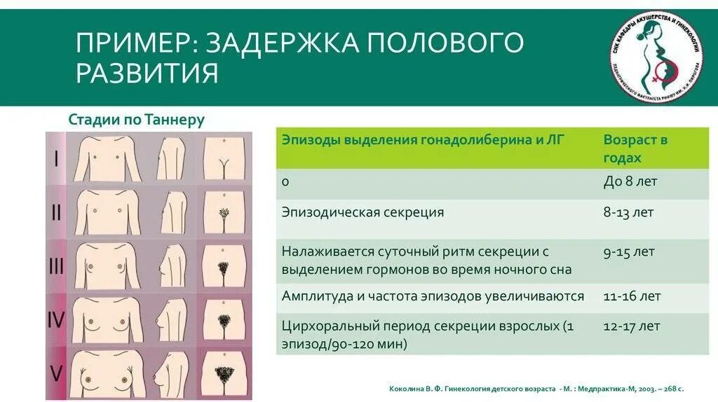 Стадии полового развития. Оценка стадии полового развития. Стадии полового развития девочек. Таблица полового созревания девочек. В каком возрасте начинают расти волосы