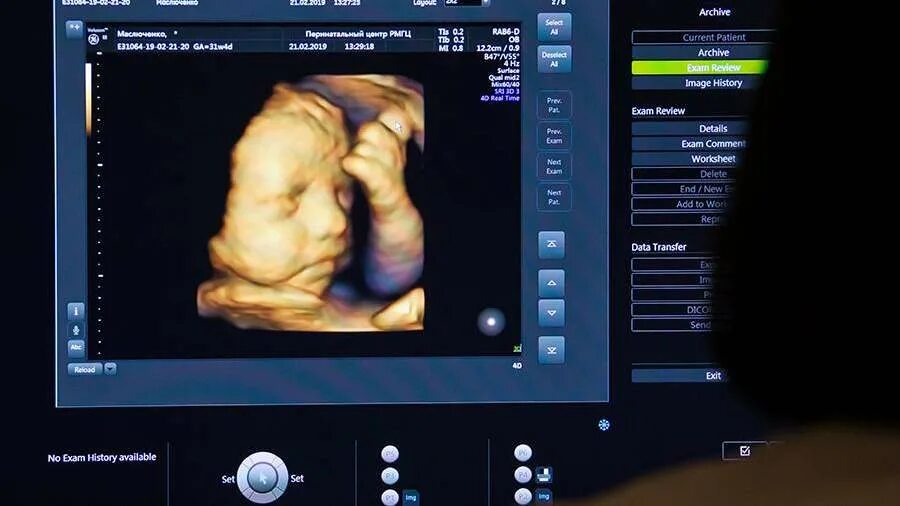 Записаться на 3 скрининг. 3д узи при беременности в москве. Узи 1 скрининг. Узи 4д беременности киров. Аёллар скрининг.