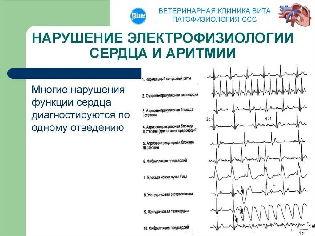 Изменение сердечного ритма. Типы нарушения ритма сердца. основные типы нарушений сердечного ритма. нарушения ритма сердца экг. типы аритмий на экг.