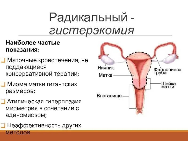 Особенности строения миометрия. Строение миометрия матки. Миома матки гиперплазия эндометрия