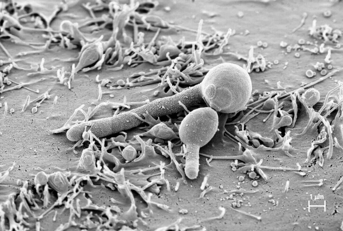 Молочница гриб. Кандида альбиканс под микроскопом. Грибок кандида под микроскопом.