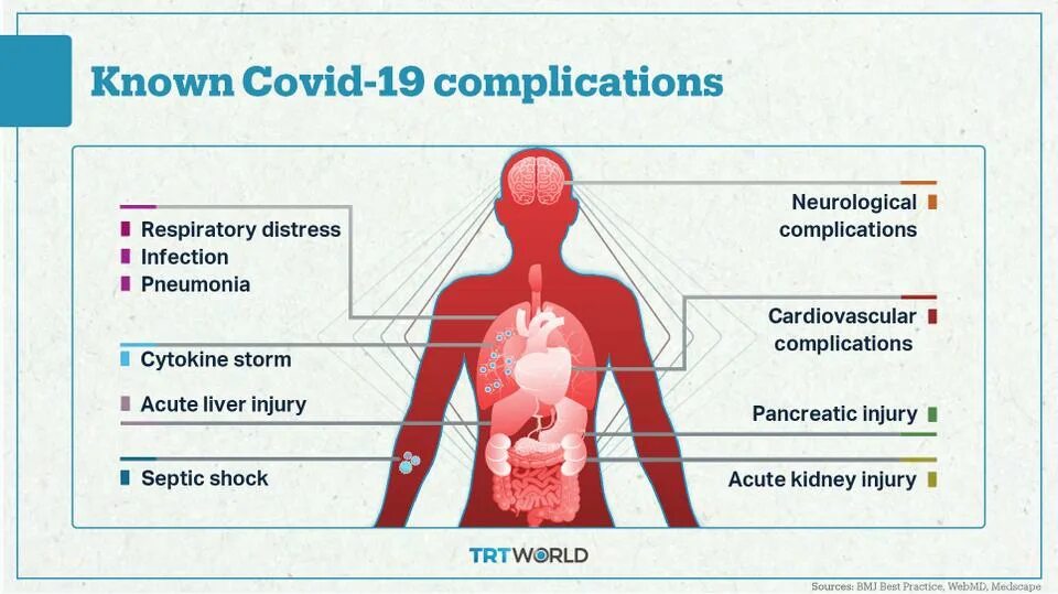 Covid 19 Complications. Covid-19 клиническая картина.