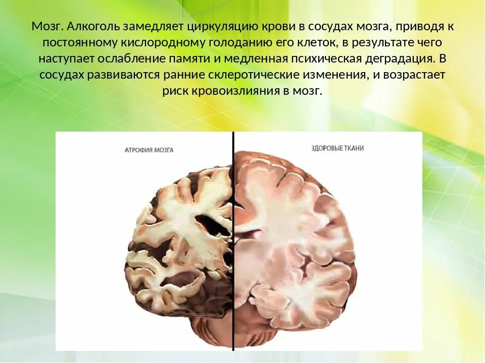 Факторы влияющие на мозг. Влияние спирта на головной мозг. Деятельность головного мозга.